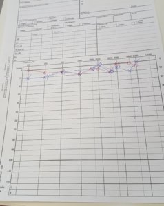audiogram.jpg