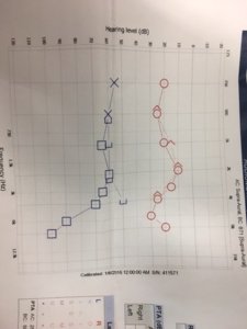 07-11-16 Hearing Test.JPG
