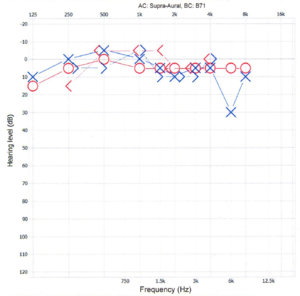 audiogram-1.jpg