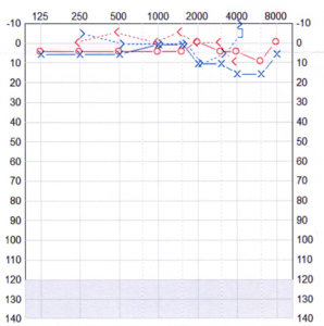 audiogram-2.jpg