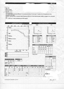 Ear Test Aug 1 2017 For Online.jpg Ear Test Aug 1 2017 For Online.jpg
