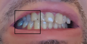 nuno_mouth.png
