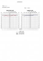 audiogram week after onset.jpg