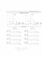 hyperacusis4.jpg hyperacusis4.jpg