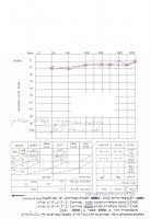 hyperacusis1.jpg hyperacusis1.jpg