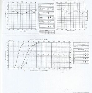 audiogramme.jpg