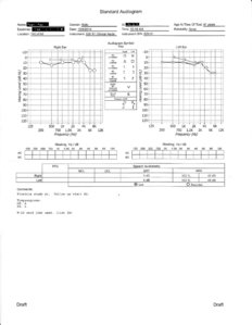 Audiogram - 20141208.jpg