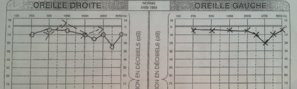 Audiogram.jpg