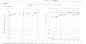 audiogram.png