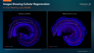 mouse cochlea.PNG