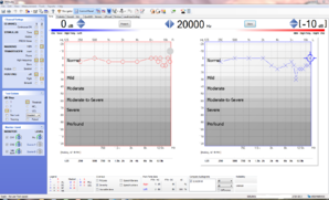 02-10-2015_Audiogram - Copy.PNG