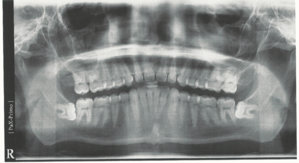 xray.jpg