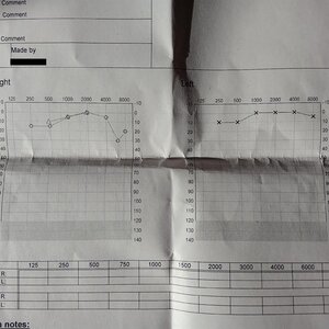 Audiogram.jpg