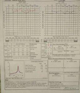 audiogram.jpg